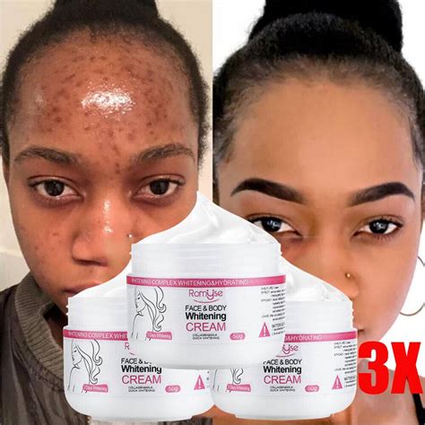 pink cheeks bleaching cream reviews|best bleaching cream for skin.